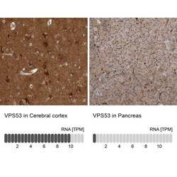 VPS53 Antibody, Novus Biologicals 25 &mu;L | Buy Online | Novus Biologicals | Fisher Scientific